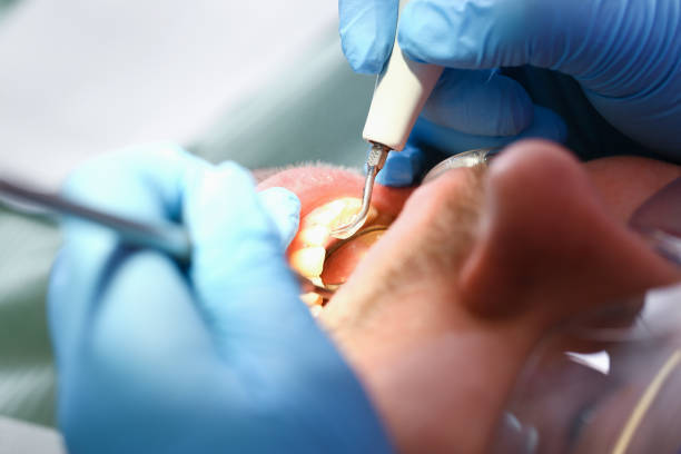 Best Emergency Tooth Extraction in Lenexa, KS