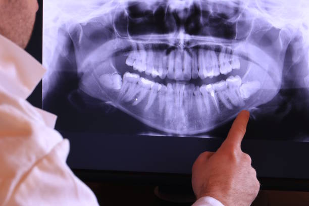 Best Emergency Treatment for Toothache in Lenexa, KS